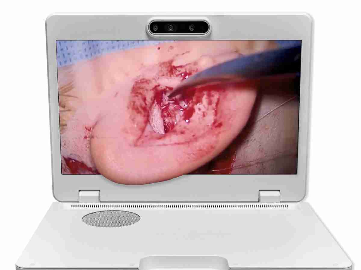 达擎之＂Heads-up 3D显微手术显示系统＂，，，整合4K裸眼3D显示及眼球追踪系统，，具备快速追踪人眼移动位置功能，，，，减轻医师长时间维持固定姿势的负担，，，，让医师能有更宽广清晰的3D立体视野及更舒适的姿势来执行手术。。。。